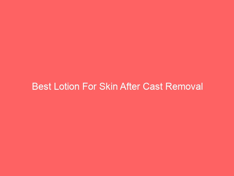 Read more about the article Best Lotion For Skin After Cast Removal